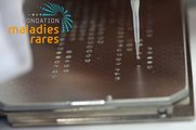 Appel à projets Fondation Maladies Rares : "GenOmics : séquençage à haut débit & maladies rares" avant le 24 mars