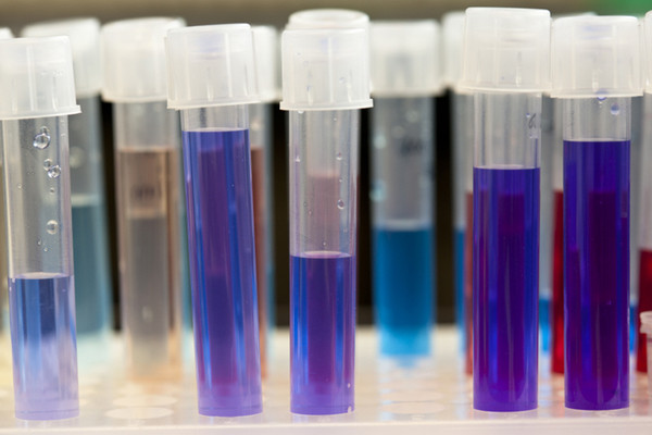 paramètres diagnostiques diagnostic tubes réactif liquide colorée laboratoire paillasse recherche pathologie endocrinienne rare